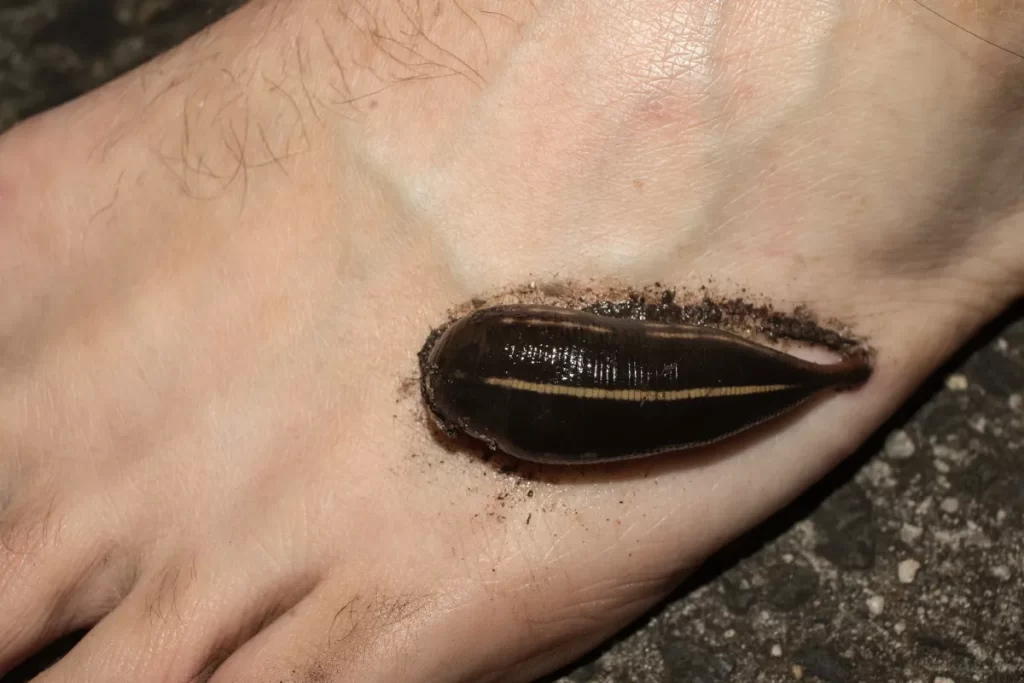 Leech on foot